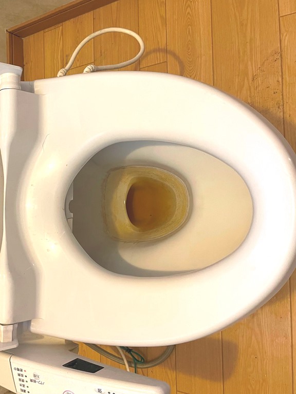 茶色に変色した便器内